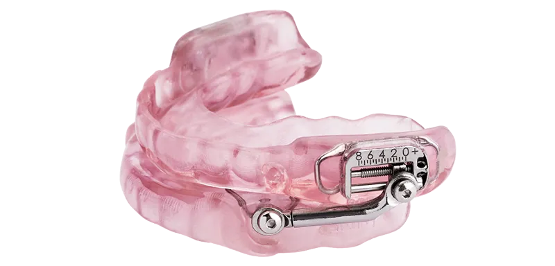 oral-appliance-sleep-apnea-1-v2 CPAP alternative | Sleep Apnea Treatment | Sacramento, CA