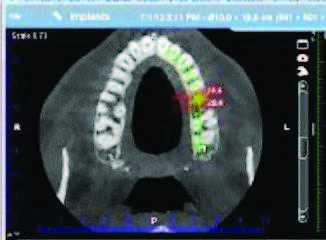 image 1 CBCT Scan