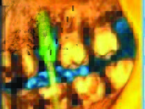 image 2 CBCT Scan