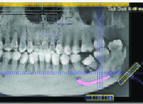 image 4 X-Ray