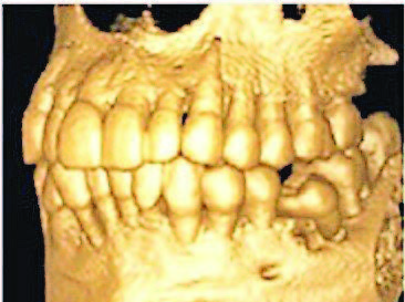 image 5 3D Scan